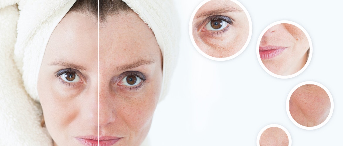لایه برداری داشتن پوست صاف پوست جذاب از بین بردن جای جوش   