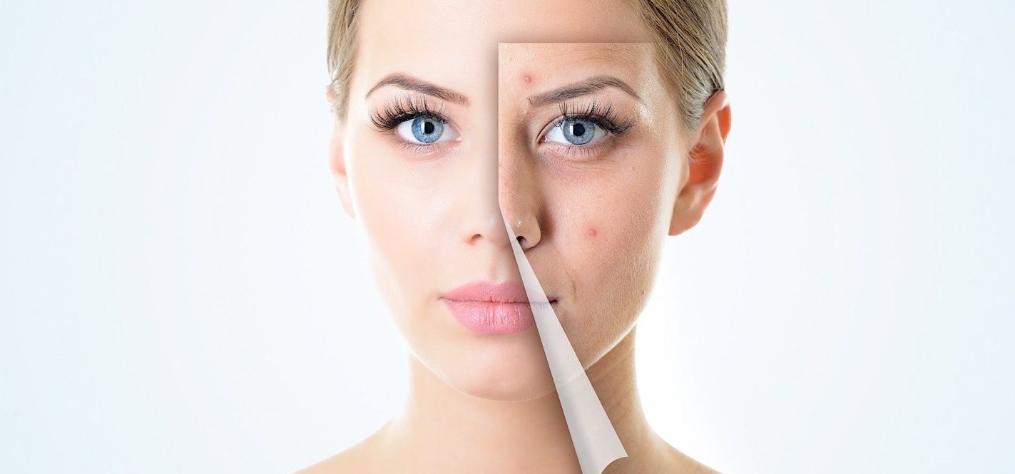 لایه برداری داشتن پوست صاف پوست جذاب از بین بردن جای جوش   
