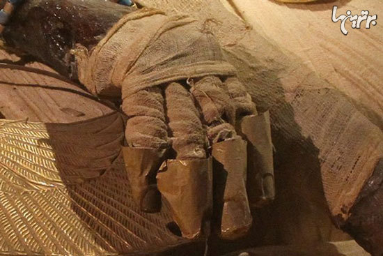 بخشهایی از بدن انسان که به حراج گذاشته شدند بخشهایی از بدن انسان که به حراج گذاشته شدند