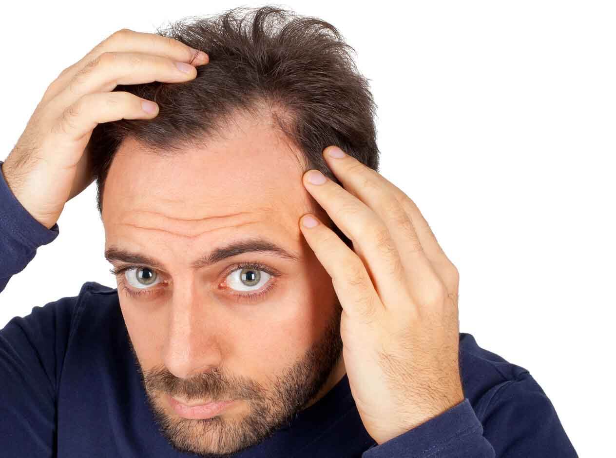 کلینیک تندیس کاشت مو کاشت ابرو   