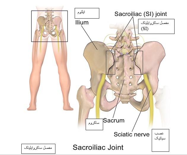 درمان درد ساکروایلیاک (مفصل خاجی) با ورزش، استراحت و فیزیوتراپی